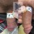 Priapus® Shot treatment case 8 thumbnail