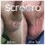 ScroTox™ Tox treatment 12 thumbnail