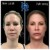 Sculptra® treatment 9 thumbnail