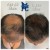 Topical Hair Treatment 1 thumbnail