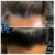 Topical Hair Treatment 11 thumbnail