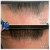 Topical Hair Treatment 13 thumbnail