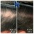 Topical Hair Treatment 14 thumbnail