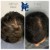 Topical Hair Treatment 15 thumbnail