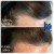 Topical Hair Treatment 16 thumbnail