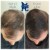 Topical Hair Treatment 2 thumbnail