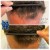 Topical Hair Treatment 4 thumbnail