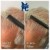 Topical Hair Treatment 5 thumbnail