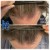 Topical Hair Treatment 6 thumbnail