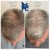 Topical Hair Treatment 7 thumbnail