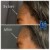 Upper Face Filler treatment 15 thumbnail
